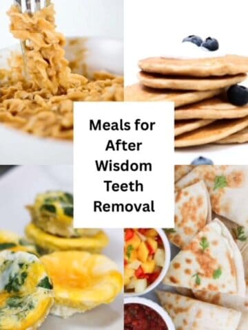 Four images of food with text in the center, "Meals for After Wisdom Teeth Removal."